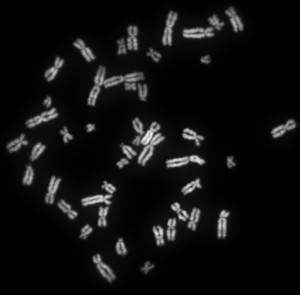 Human_female_metaphase_chromosomes