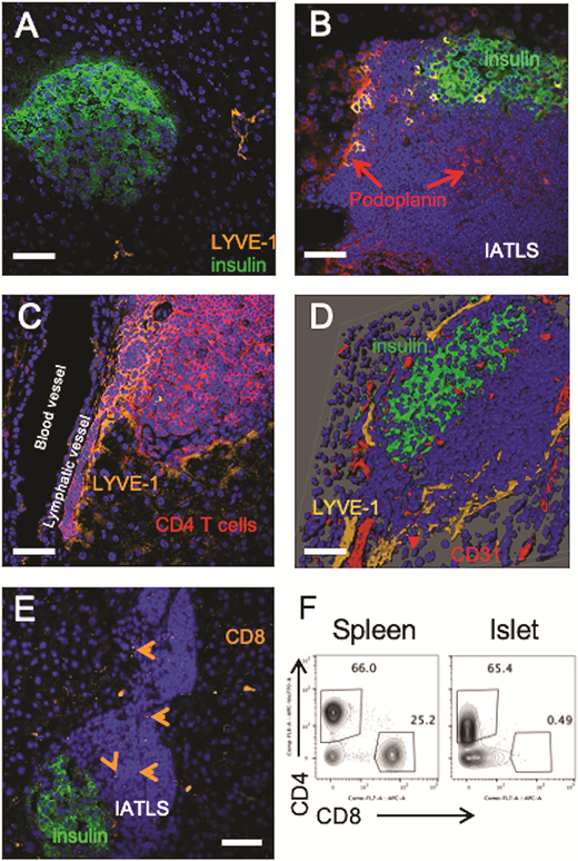 Repositioning the Early Pathology of Type 1 Diabetes to the Extraislet Vasculature