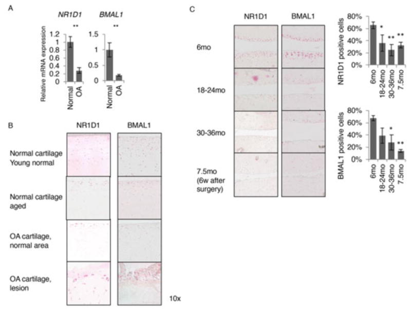 Dysregulated circadian rhythm pathway in human osteoarthritis: NR1D1 and BMAL1 suppression alters TGF-β signaling in chondrocytes