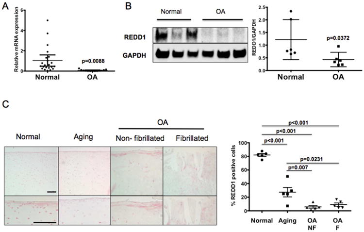 Suppression of REDD1 in osteoarthritis cartilage, a novel mechanism for dysregulated mTOR signaling and defective autophagy
