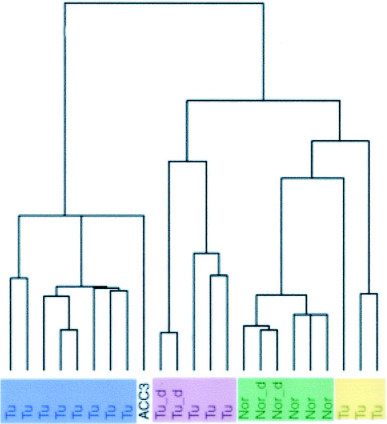 Large Scale Molecular Analysis Identifies Genes with Altered Expression in Salivary Adenoid Cystic Carcinoma