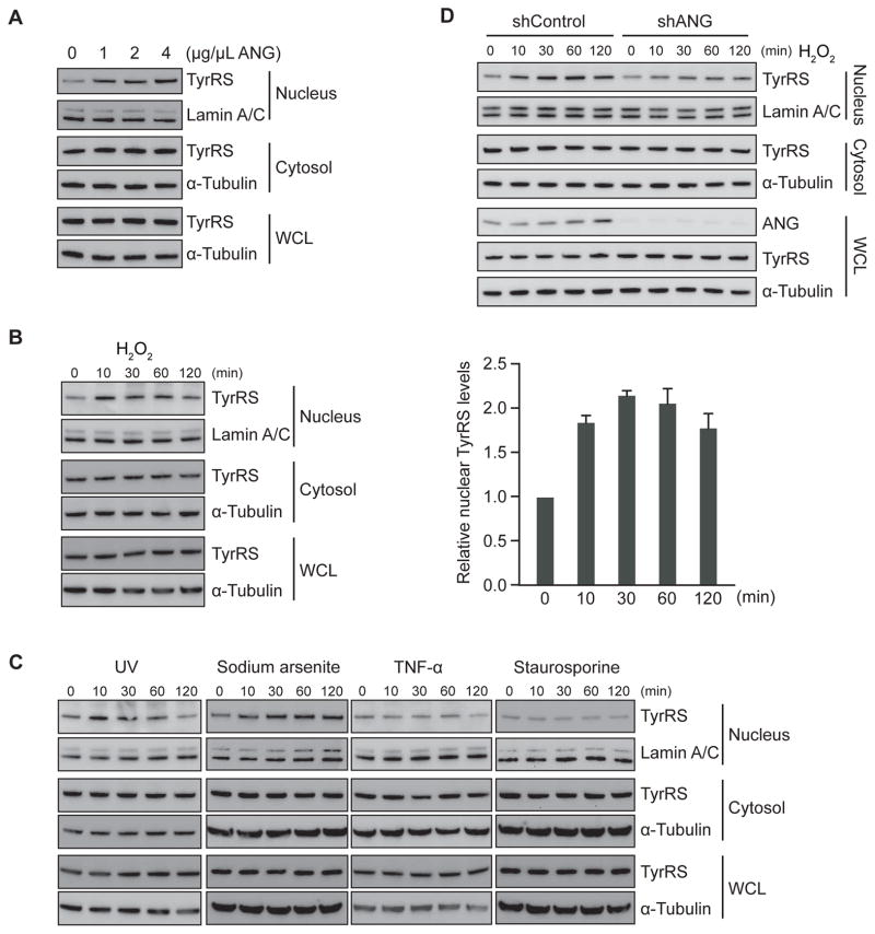 Oxidative Stress Diverts tRNA Synthetase to Nucleus for Protection against DNA Damage