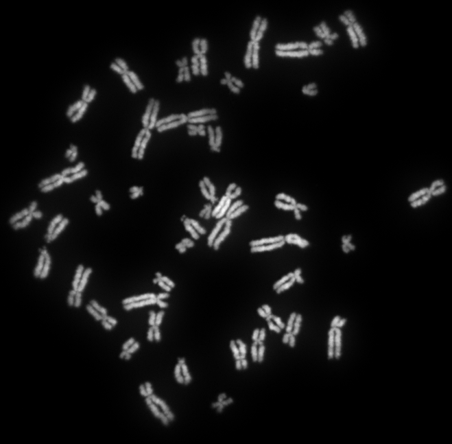 Human_female_metaphase_chromosomes